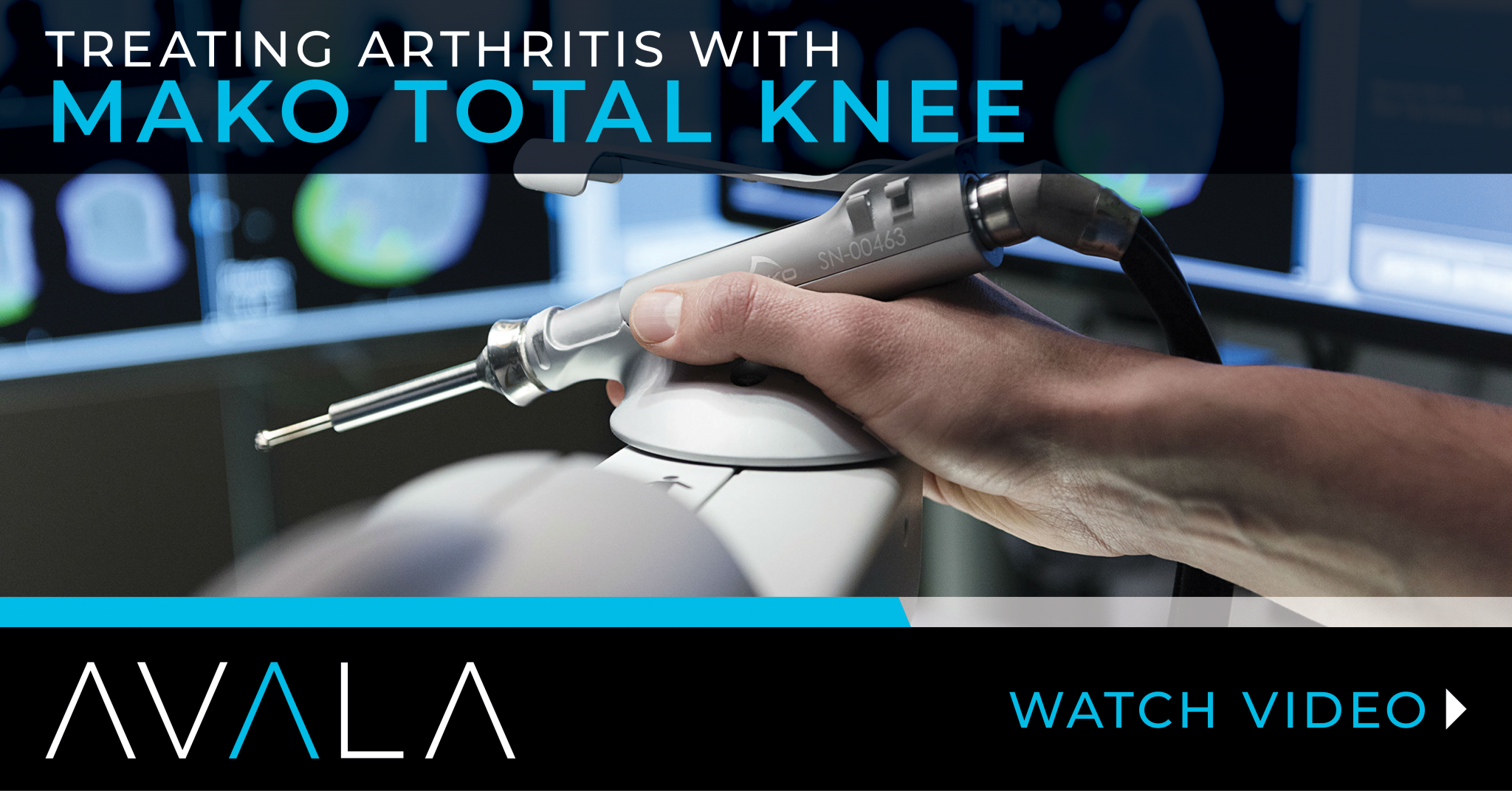 Robotic Knee Surgery Video AVALA