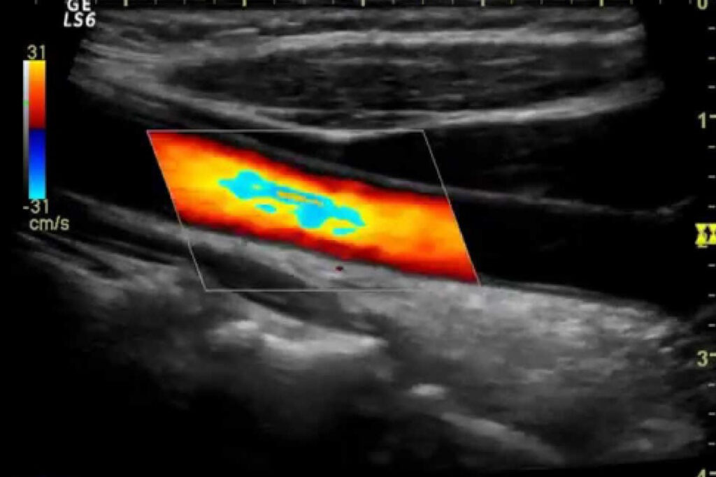 Imaging - AVALA