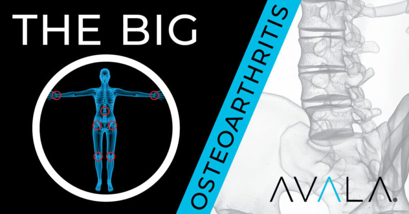 The Big O - Osteoarthritis