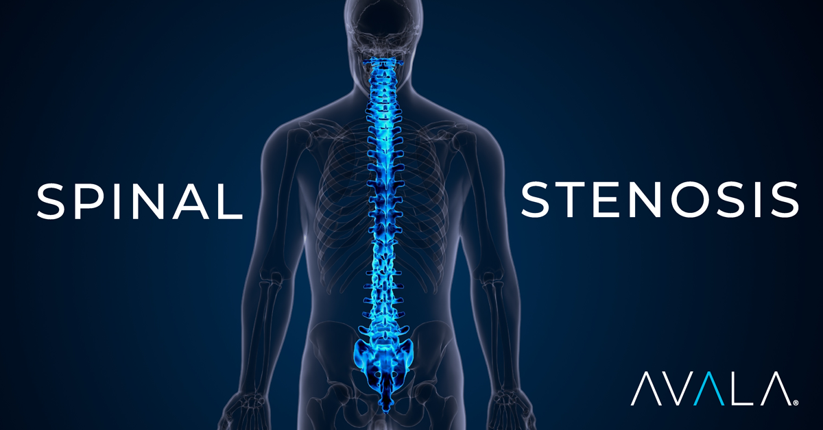 Spinal-Stenosis2