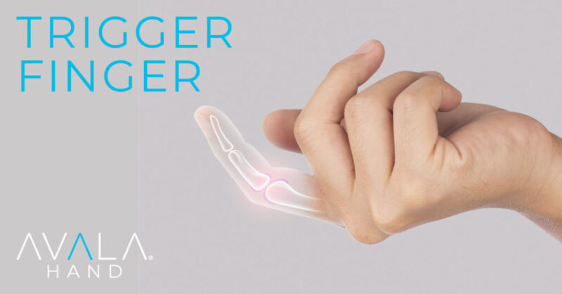 Trigger-Finger