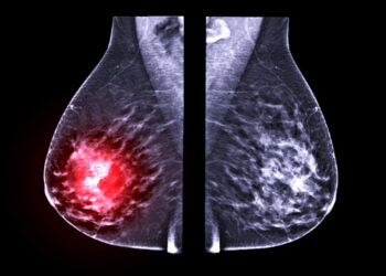 pink mammography machine