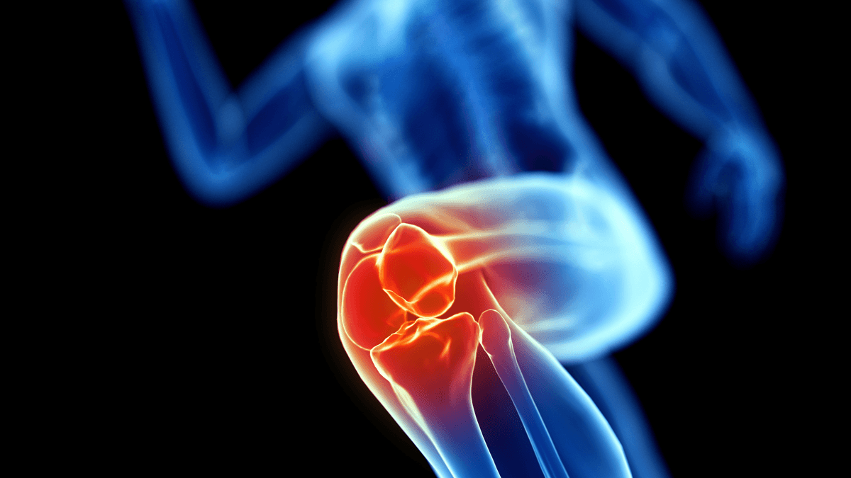 JOINT REPLACEMENT SURGERY